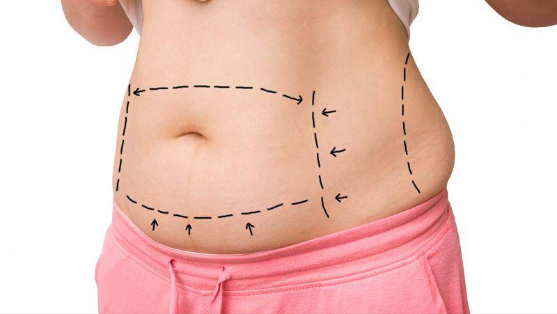 cosmeticplasticsurgerylongisland.com