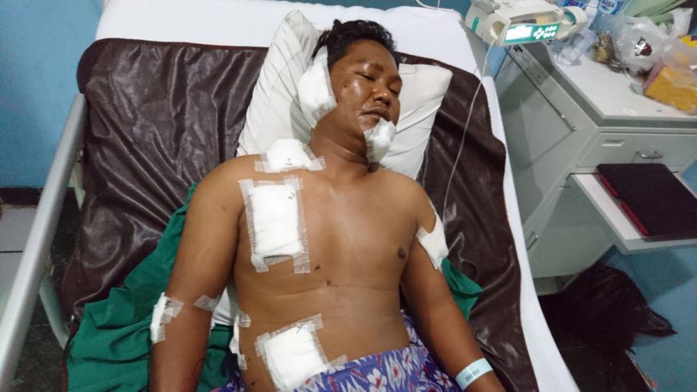 Satpam Digigit Anjing Belum Dapat Ganti Rugi, Warga Galang Sumbangan