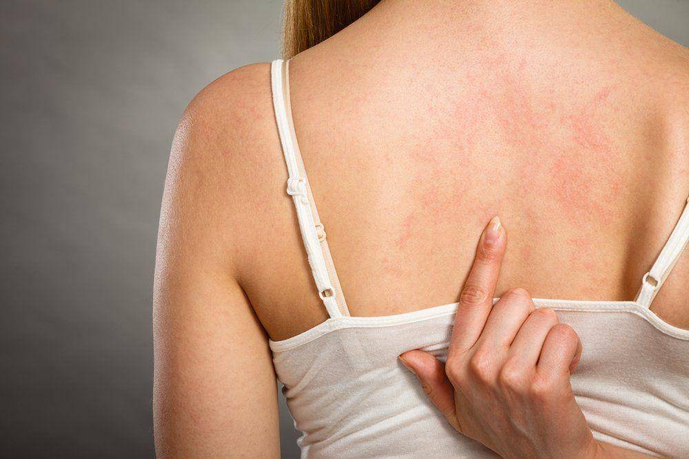 drscabies.com