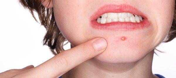 acne.com