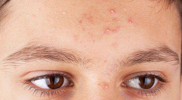 proactiv.com