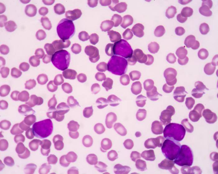 medicalnewstoday.com