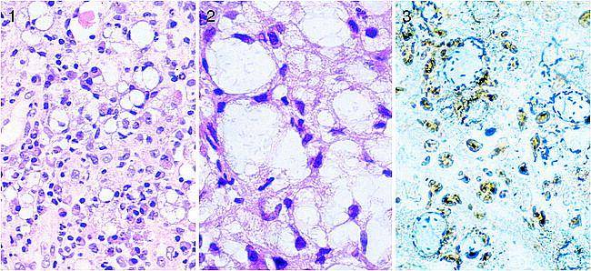 pathologyoutlines.com
