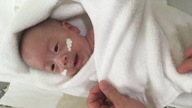 Keio University Hospital via bbc.com