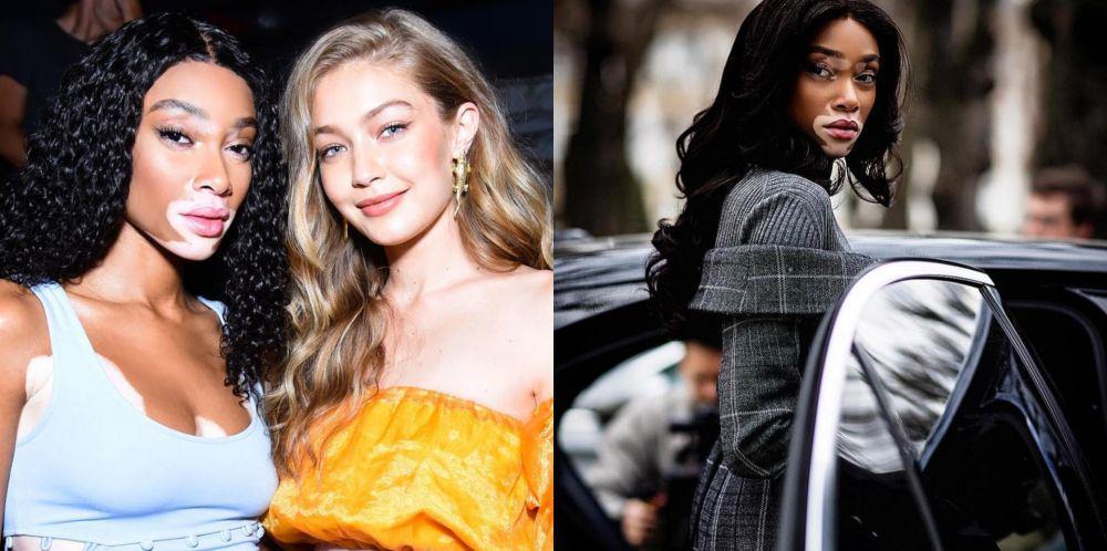 11 Fakta Hidup Seorang Winnie Harlow, Model Top Ubah Definisi 'Cantik'