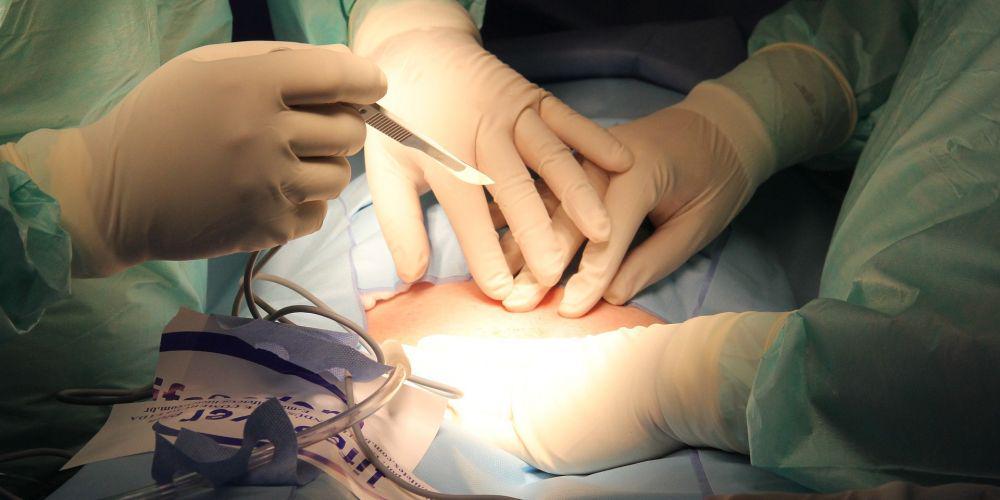 9 Tips Merawat Luka Bekas Jahitan Operasi Caesar