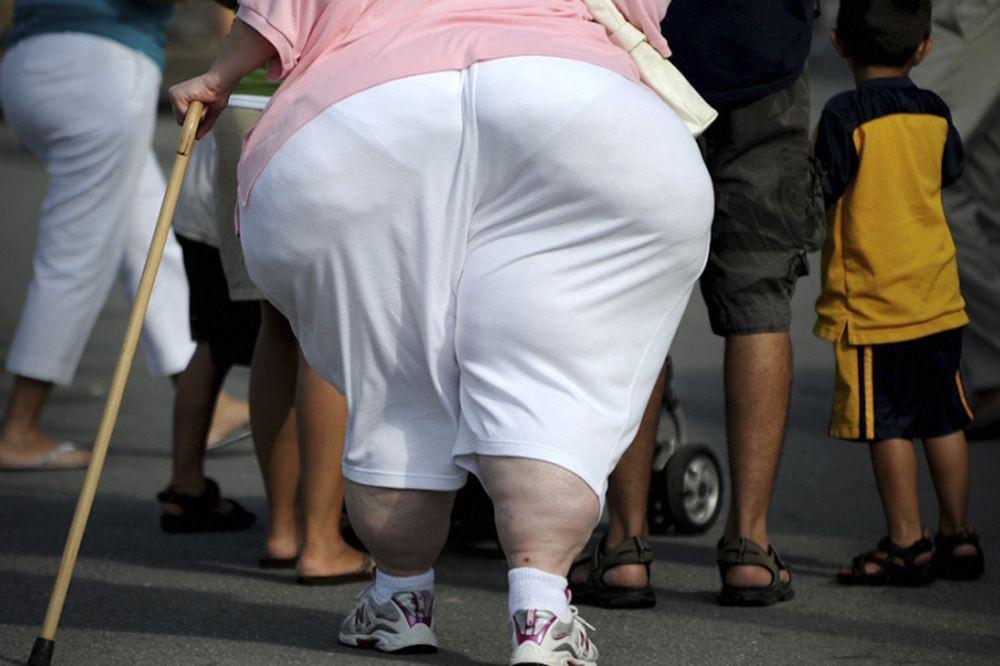 Begini Efek Dahsyat Fat Shaming yang Gak Kita Duga, Stop Melakukannya!