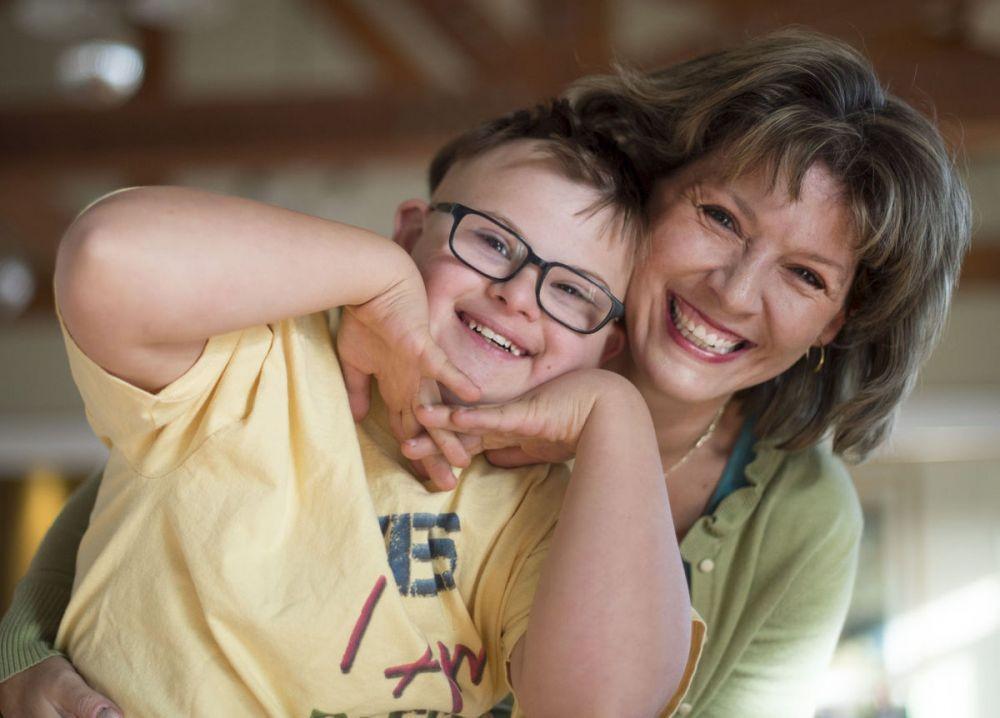 10 Fakta Down Syndrome, yuk Tumbuhkan Empati pada Mereka