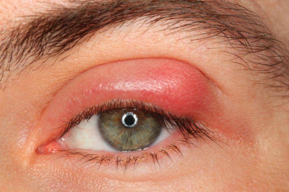 harvardsquareeyecare.com