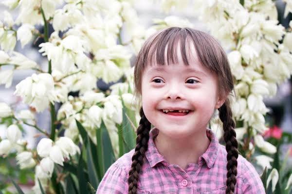 Yuk Mengenal 4 Macam Kelainan Trisomi, Down Syndrome Itu Salah Satunya