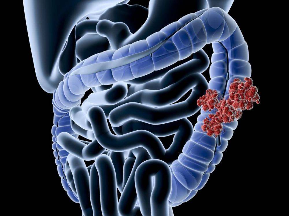 medicalnewstoday.com