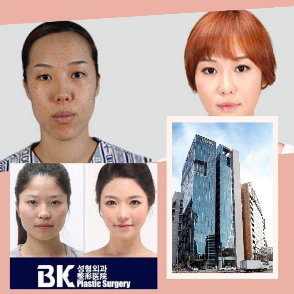 english.bkhospital.com