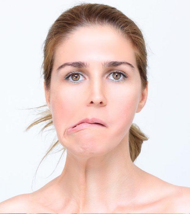 6 Fakta Bell's Palsy, Penyakit Kelumpuhan yang Menyerang Separuh Wajah