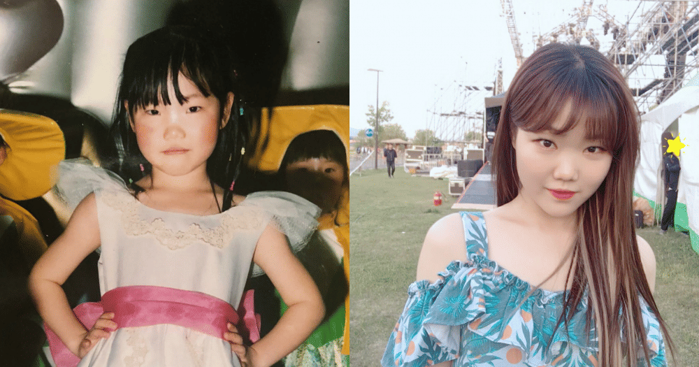 Punya Hidung Mungil, 10 Potret Suhyun AKMU yang Justru Makin Imut
