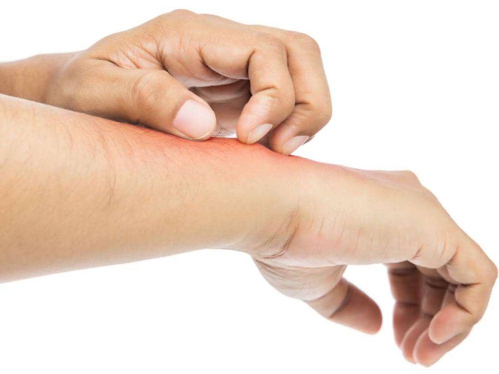 medicalnewstoday.com