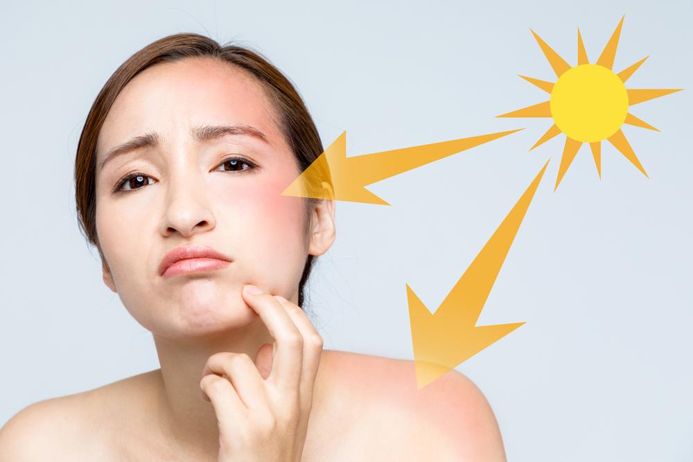 5 Kesalahan Pemakaian Sunscreen Ini Bisa Menyakiti Kulitmu