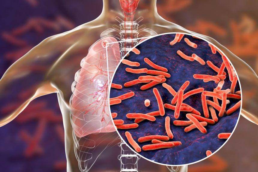 infectiousdiseaseadvisor.com