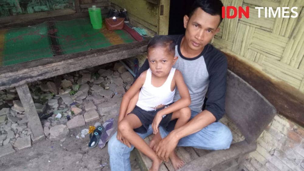 Butuh Uluran Tangan, Bocah 7 Tahun asal Langkat Alami Jantung Bocor