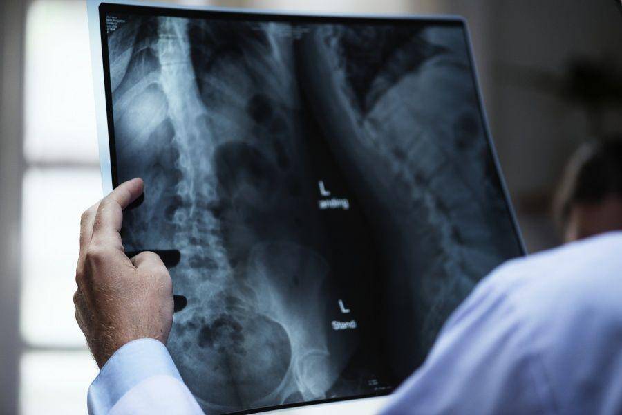 spineuniverse.com