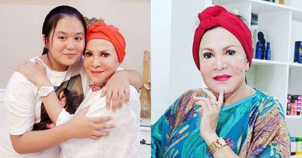 Jalani Operasi Angkat Silikon Wajah, 10 Potret Terbaru Mpok Atiek