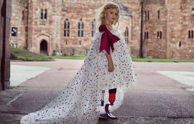 10 Potret Daisy, Model Cilik Tanpa Kaki yang Sukses di Catwalk Dunia