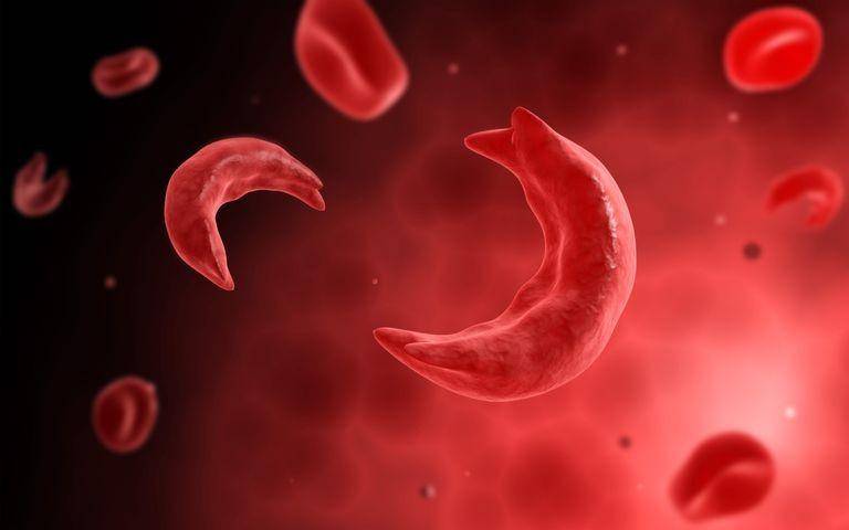 verywellhealth.com