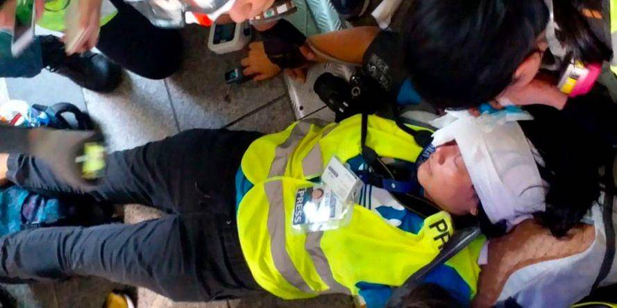 (Jurnalis Indonesia Veby Mega Indah usai tertembak peluru karet) SCMP/Mimi Lau