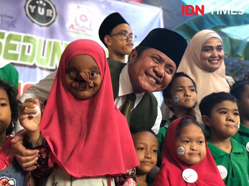 Senyum Bersama Penderita Bibir Sumbing, Herman Deru: Saya mau Nangis
