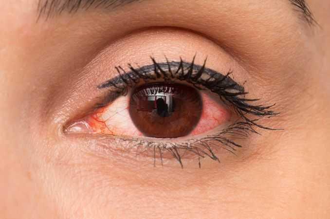 allaboutvision.com