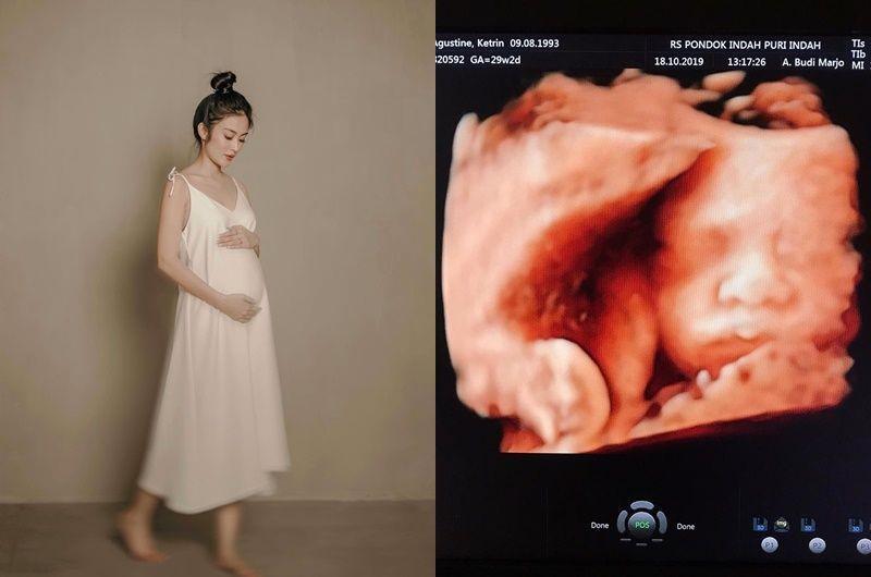 10 Pesona Ketrin Agustine dengan Baby Bump, Anggunnya Kebangetan!