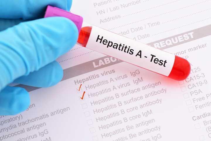 Hepatitis A: Ini Gejala, Pencegahan, dan Pengobatannya
