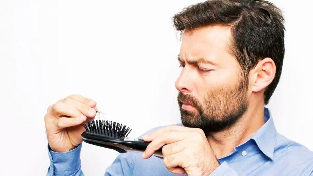 Ilustrasi rambut rontok (klikdokter.com)