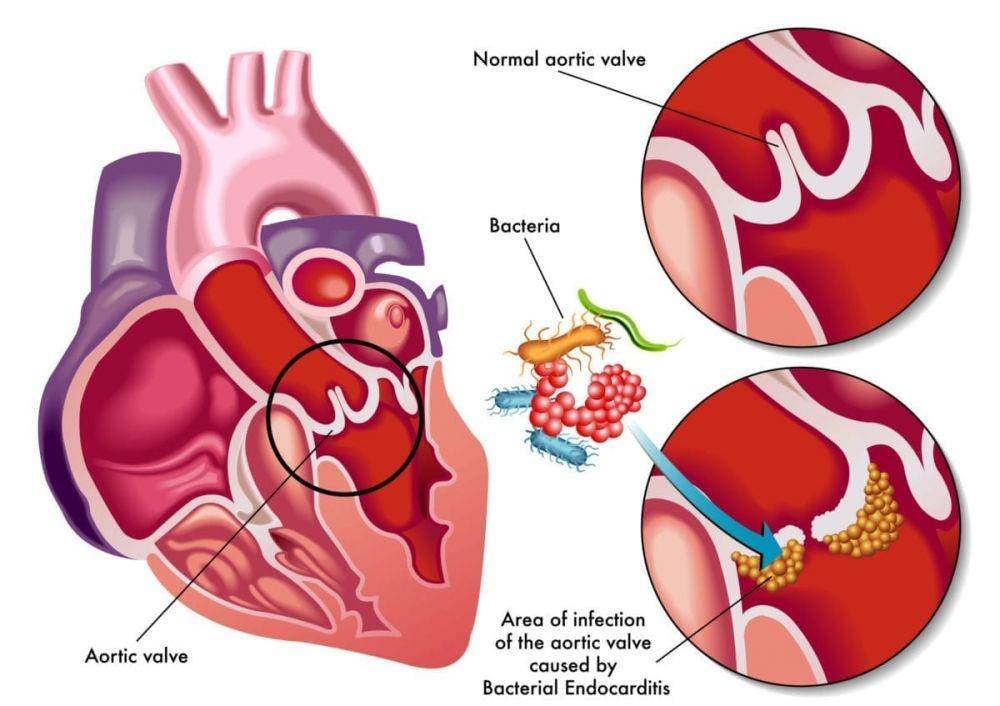 familydoctor.org