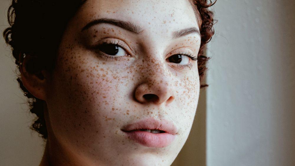 Skincare 101: Perbedaan Antara Tahi Lalat, Bintik, dan Tanda Lahir