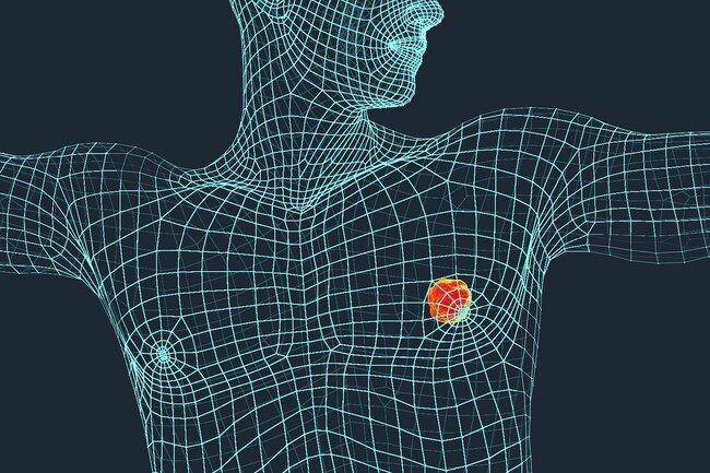 ilustrasi kanker payudara pada laki-laki (webmd.com)