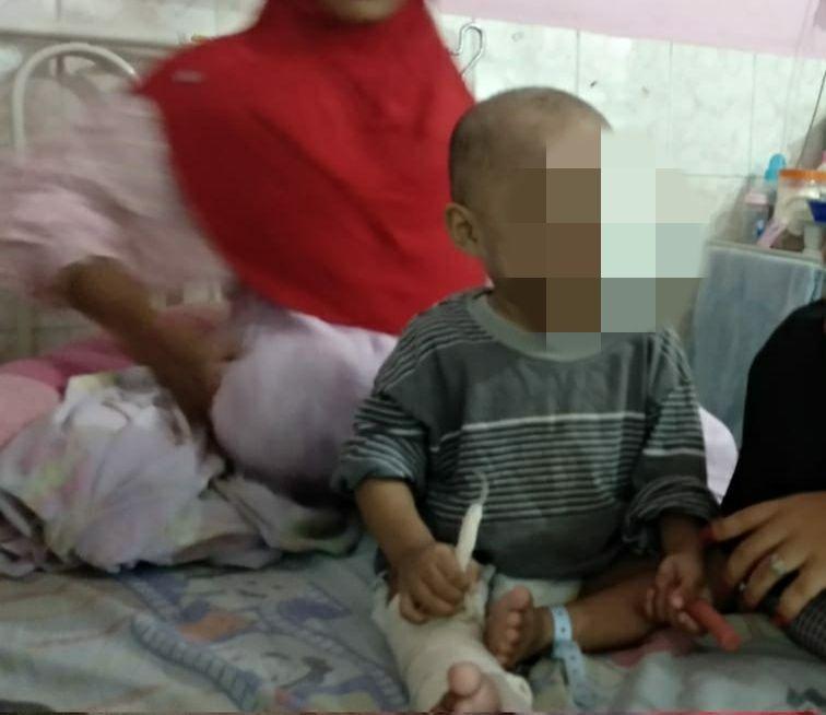 Budi--bukan nama sebenarnya--balita yang disiksa ibu kandungnya hingga kakinya patah (IDN Times/Yuda Almerio)