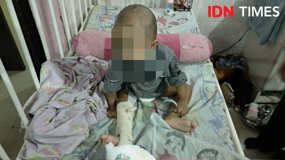 Budi--bukan nama sebenarnya--balita yang disiksa ibu kandungnya hingga kakinya patah (IDN Times/Yuda Almerio)