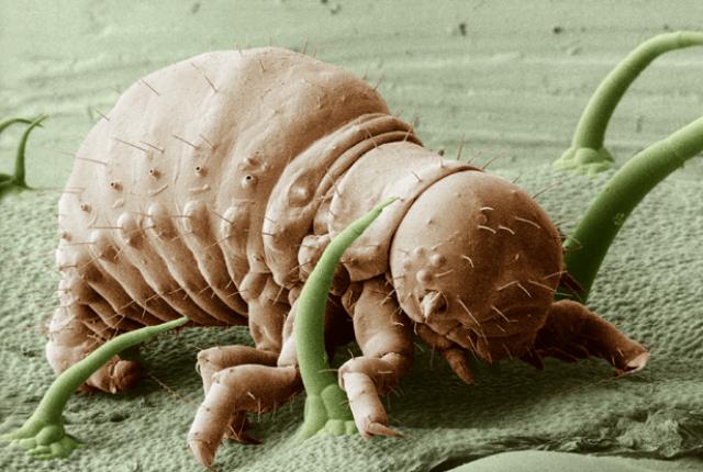 9 Monster Mikroskopis yang Merugikan Manusia, Lihatnya Bikin Merinding