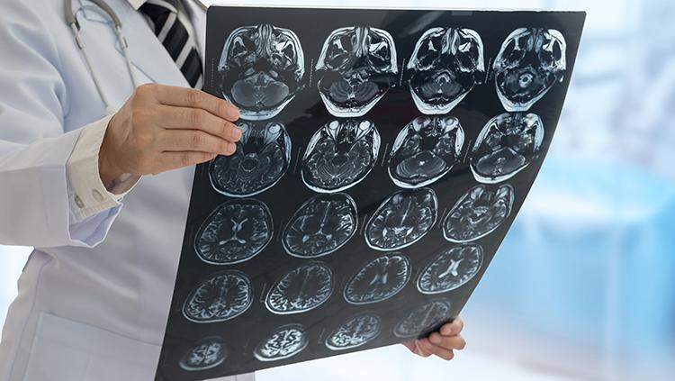 brainfacts.org