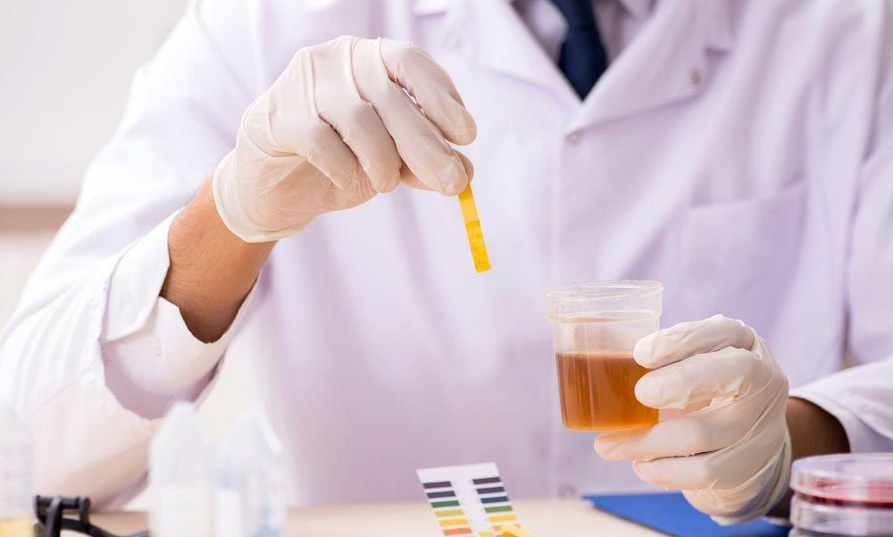 Ini 10 Arti Warna Urine terhadap Kesehatanmu, Apakah Kamu Cukup Minum?