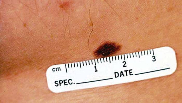 clevelandclinicmeded.com