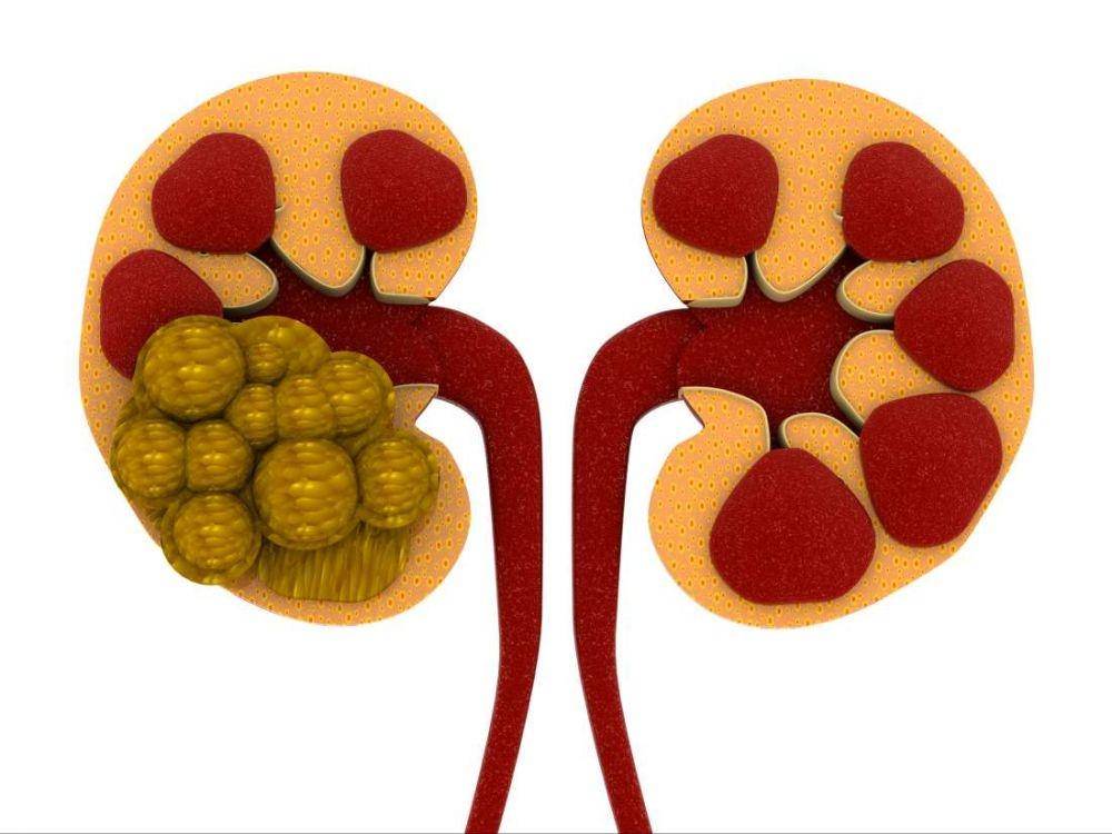 medicalnewstoday.com