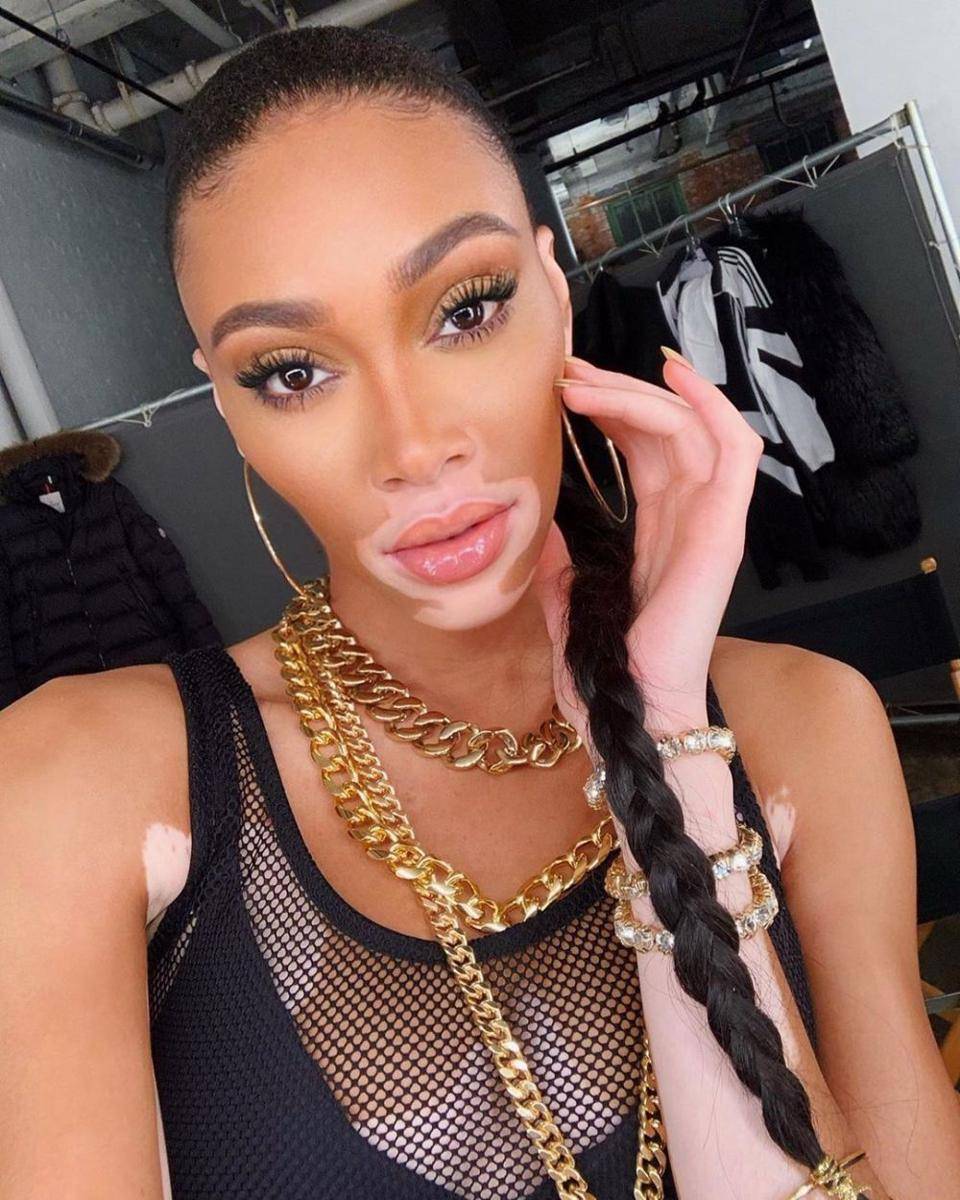 instagram.com/winnieharlow