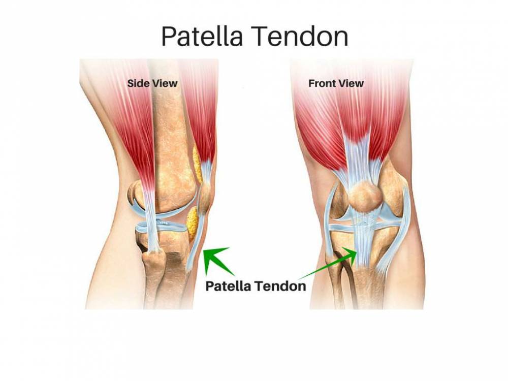 physiofitadelaide.com.au