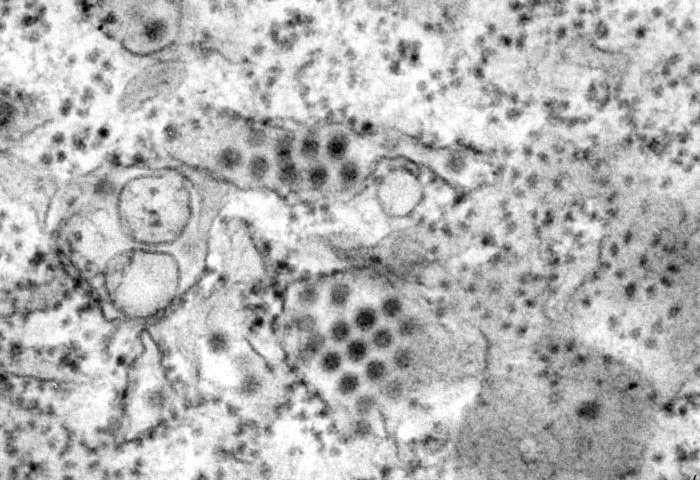ilustrasi virus dengue (medicalxpress.com)