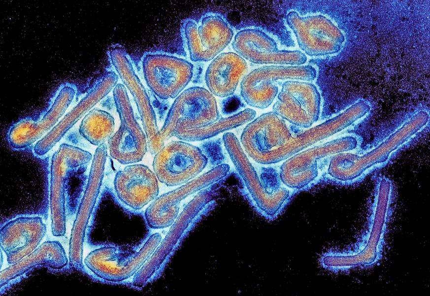 ilustrasi virus Marburg (nih.gov)