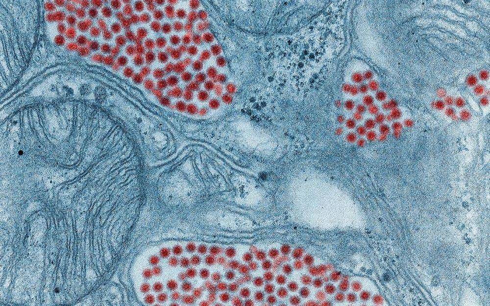 ilustrasi arbovirus (duluthnewstribune.com)