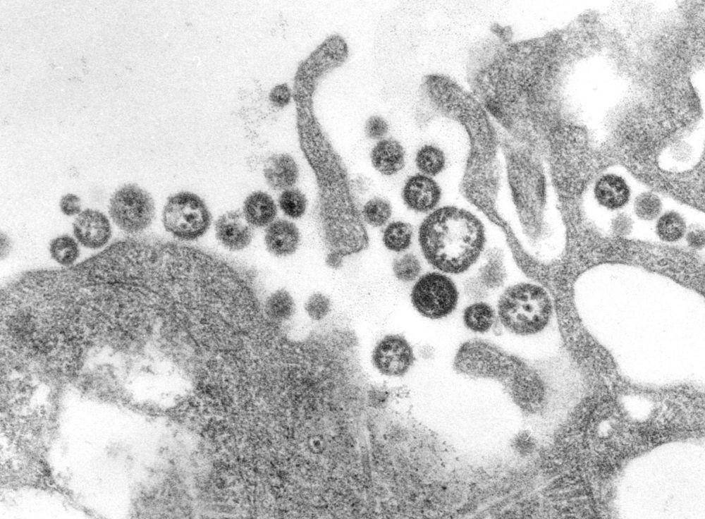 ilustrasi Lassa mammarenavirus (wikipedia.org)