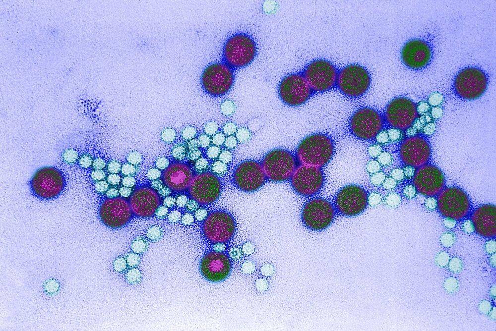 ilustrasi rotavirus (infectiousdiseaseadvisor.com)