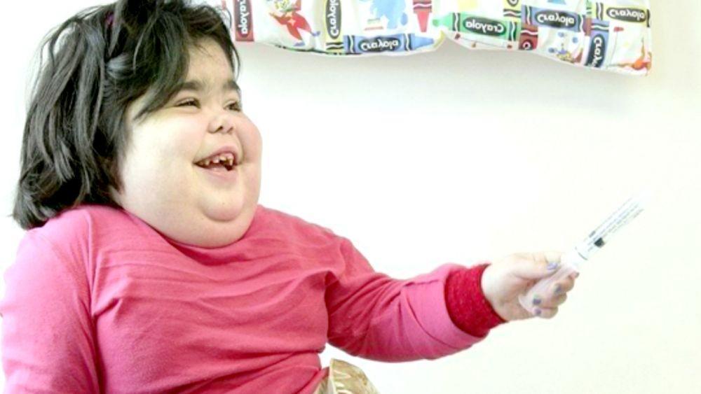 15 Anak Ini Terlahir dalam Keadaan Dianggap Mengerikan, Kenapa Begitu?